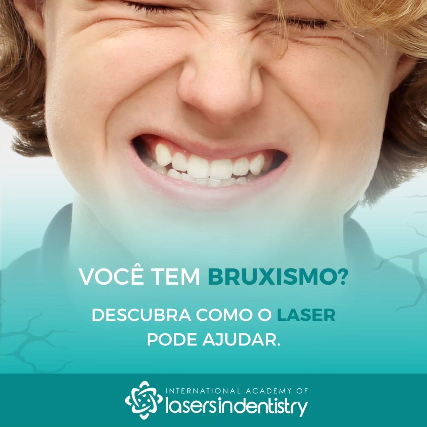 Você tem bruxismo? Descubra como o laser pode ajudar