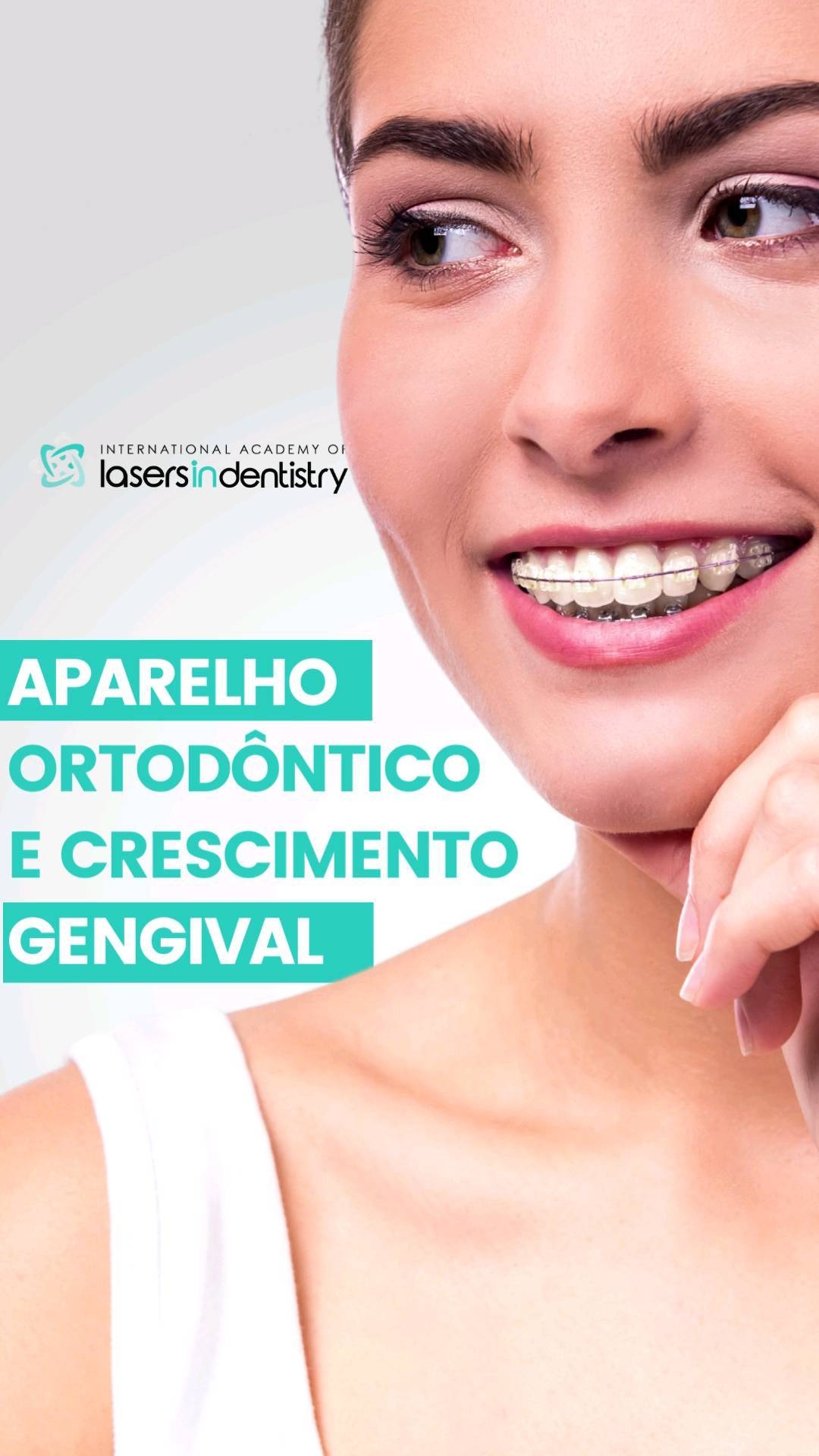 Aparelho ortodôntico e crescimento gengival